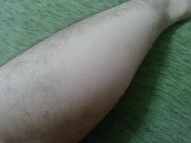 Bacak Kıllarının Dökülme Nedenleri ve Sağlıklı Bakım İpuçları