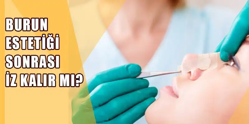 Burun Estetiği Sonrası Dikiş İzleri İçin Krem Kullanımı ve Bakım Yöntemleri