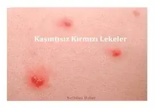 Derideki Kir ve Lekelerin Nedenleri ve Etkili Bakım Yöntemleri Hakkında Kapsamlı Rehber