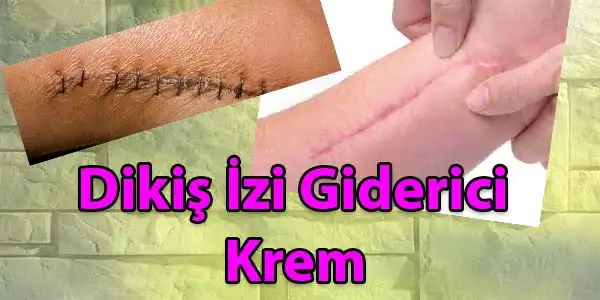 Diken İzi Nedir, Nasıl Azaltılır ve Kozmetik Yöntemlerle Gelişmiş Çözümler