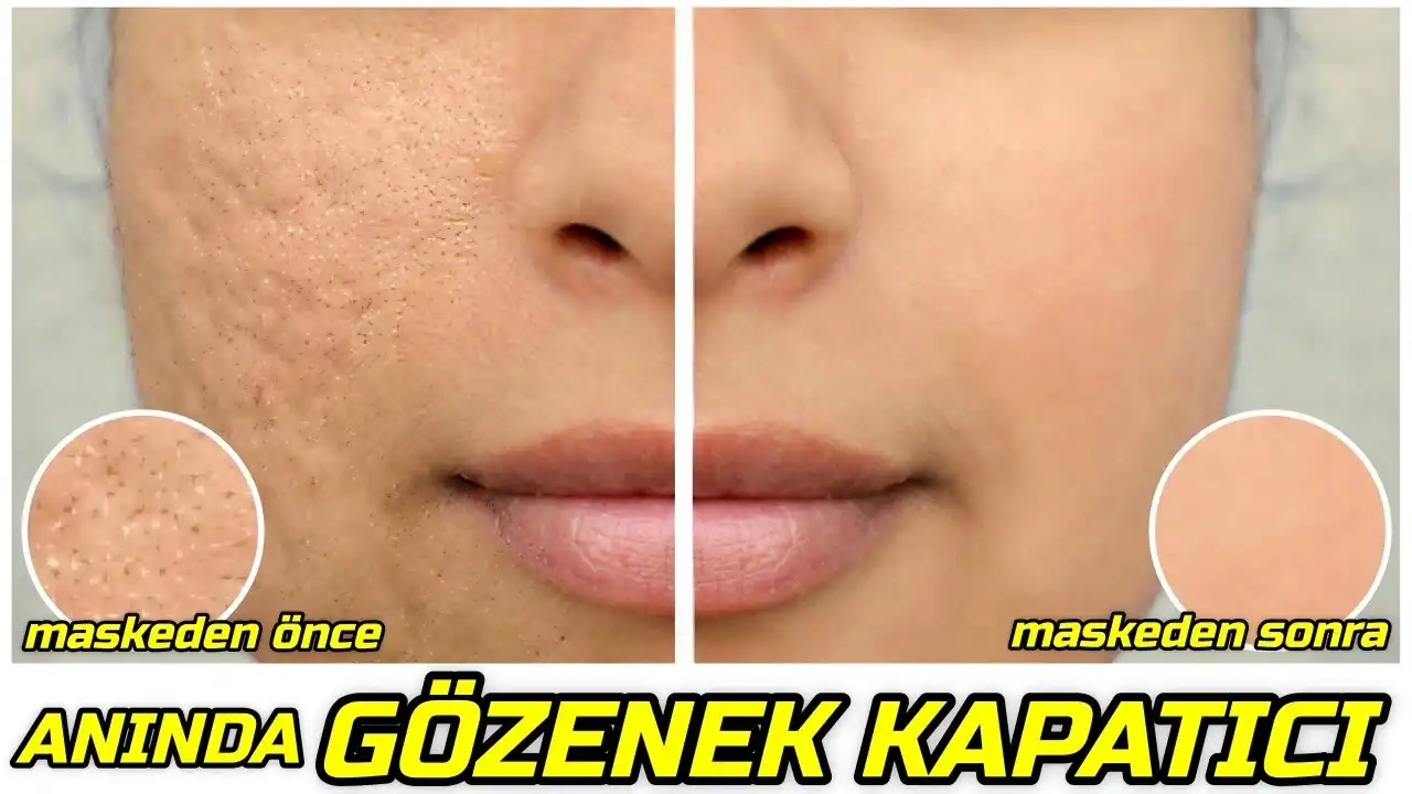 Gözenekleri Küçültme Yöntemleri ve Cilt Güzelliği İçin Etkili Tavsiyeler