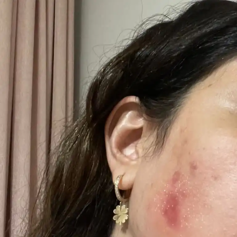 Gül Suyu: Doğal Güzellik ve Cilt Bakımında Temel Rolü ve Kullanım Alanları