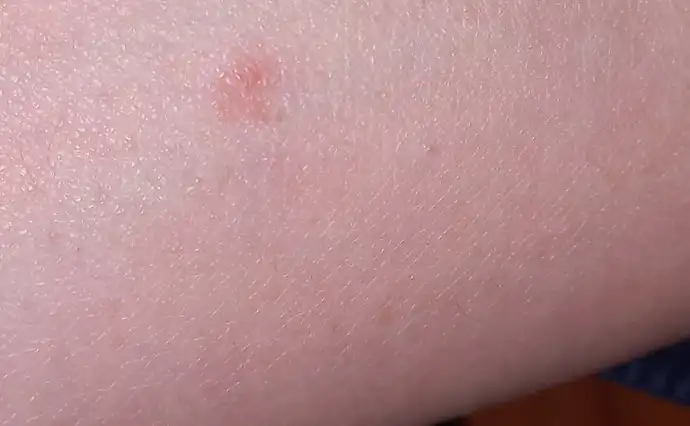Kolda Yeşil Leke Nedenleri, Çözümleri ve Koruyucu Yöntemler Hakkında Detaylı Bilgi