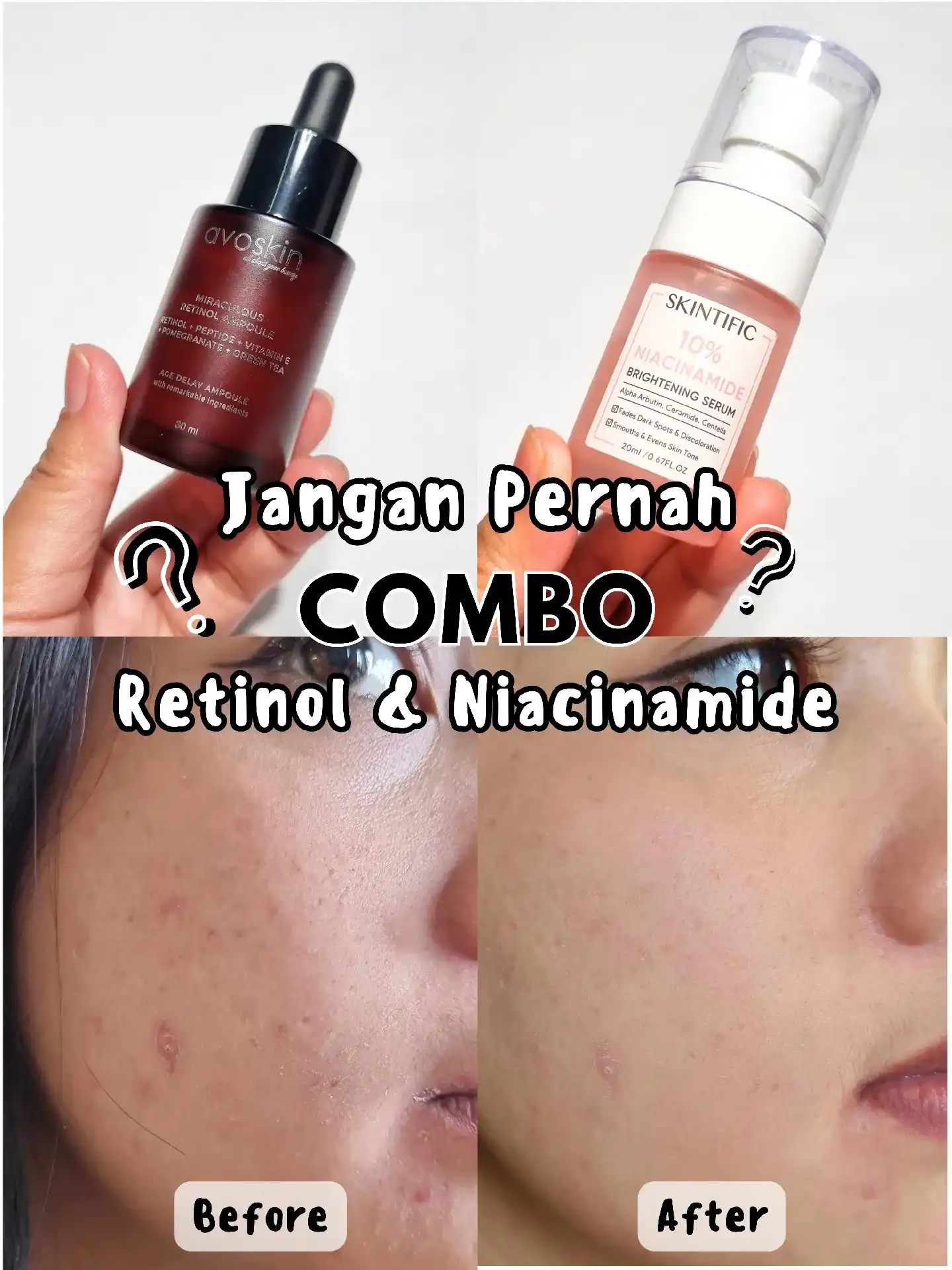Niacinamide ve Retinol Kullanımı: Cilt Bakımında Güçlü ve Güvenli Bir Kombinasyon