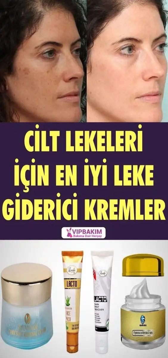 Cilt Lekeleri İçin En Etkili Krem Rehberi ve Doğru Kullanım İpuçları
